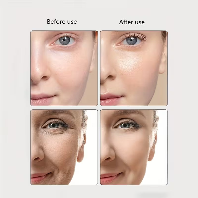 Valora Age-R Booster Professional Facial Massager